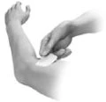 A hand applies a white patch to the upper arm of a person in a black-and-white photograph