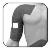 Black-and-white diagram of a male torso with a patch applied on the upper right arm, featuring a grid of squares