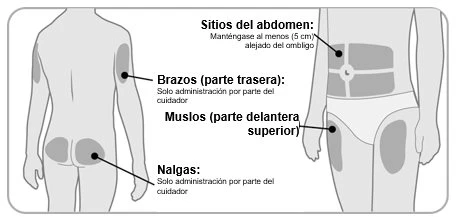Medical diagram indicating injection sites on arms, buttocks, and abdomen away from the navel