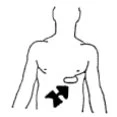 Disegno schematico del busto umano con una freccia nera spessa che indica la zona dell'addome superiore destro