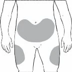 Human body diagram showing gray areas on the