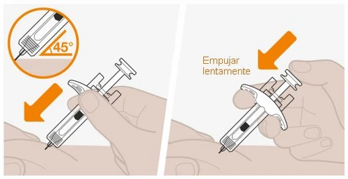 Due illustrazioni mostrano come impugnare una siringa sulla pelle a 45 gradi e spingerla lentamente verso il basso con una mano