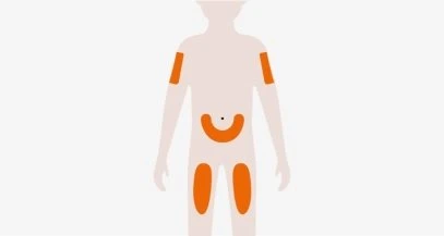 Stylized silhouette of a human body with orange-highlighted areas on the arms, thighs