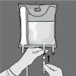 Mani guantate che regolano la valvola di un sacchetto per infusione contenente liquido tramite un tubo di drenaggio con una freccia nera verso l'alto