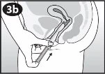 Medical diagram showing the