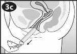 Medical diagram in sagittal section showing the