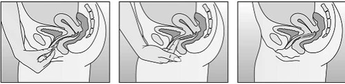 Three medical diagrams showing the