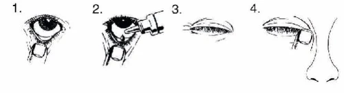 Sequence of four drawings showing the
