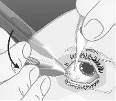 Medical drawing showing hands using a scalpel and tweezers to perform a surgical procedure on the
