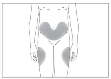 Schema del corpo umano che mostra aree grigie sulla parte inferiore dell'addome e sulla parte superiore delle cosce destra e sinistra