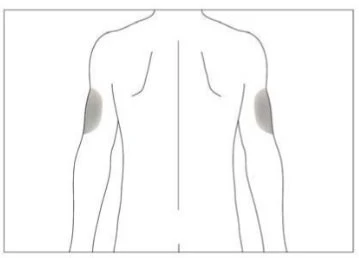 Disegno schematico del busto e delle braccia di una persona vista di schiena con due aree grigie evidenziate sulla parte superiore di entrambi i bicipiti