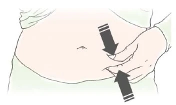 Una mano pizzica la pelle dell'addome creando una piega, con due frecce nere che indicano il movimento di trazione verso l'alto