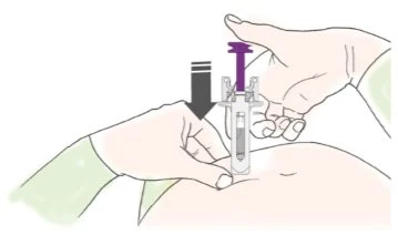 Due mani tengono un dispositivo medico trasparente sulla pelle dell'addome mentre una freccia nera indica il movimento di pressione verso il basso
