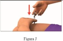 Una mano tiene una siringa con ago puntato verso la parte superiore della coscia di una persona con una freccia rossa che indica il movimento verso il basso