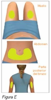 Diagramma medico con tre illustrazioni di corpi umani che mostrano aree gialle per l'iniezione su cosce, addome e parte posteriore del braccio