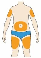 Diagramma di un corpo umano con zone arancioni su braccia, addome e cosce che indicano i siti di applicazione del farmaco