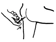 Disegno schematico di una mano che impugna una siringa per eseguire un'iniezione sottocutanea nel grasso addominale con un angolo di 45 gradi