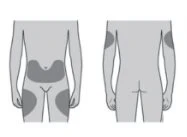 Diagram of the human body showing dark gray areas on the