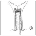 Disegno anatomico in bianco e nero che mostra la sezione trasversale di un condotto biologico con pareti muscolari e struttura interna dettagliata