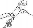 Disegno a tratto che mostra due mani che tendono e tirano la pelle di un braccio per preparare la zona all'uso