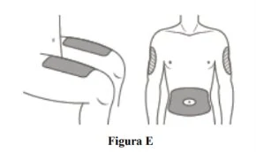 Diagramma medico che mostra i siti di applicazione di un cerotto su braccio, parte superiore della schiena e addome di un busto umano