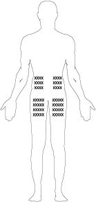 Silhouette stilizzata di un corpo umano con gruppi di piccole croci nere disposte sopra