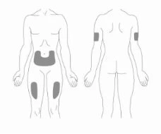 Diagramma del corpo umano che mostra aree grigie sull'addome, sulle cosce e sulla parte superiore delle braccia per l'applicazione del farmaco