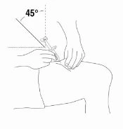 Disegno tecnico che mostra due mani che inseriscono un ago nel gluteo con un'inclinazione di 45 gradi rispetto alla superficie della pelle