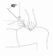 Disegno tecnico che mostra l'inserimento di un ago nella pelle con un'inclinazione di 45 gradi rispetto alla superficie del corpo