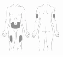 Schematic drawings of the human body showing the application sites of the medication on the