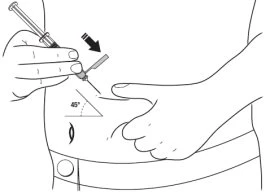 Technical drawing showing a hand inserting a needle into an abdomen with a
