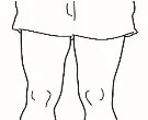 Line drawing showing the lower torso and legs of a person with knees highlighted to indicate the application area