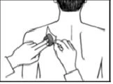 Disegno stilizzato di una persona di spalle mentre due mani applicano un cerotto o un dispositivo medico sulla parte superiore della schiena