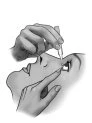 Black and white drawing of a person inserting a medical device into the mouth while a hand supports the chin to stabilize it