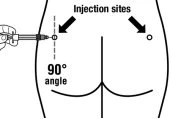 Diagramma medico che mostra due siti di iniezione sul gluteo con una siringa che si inserisce a un angolo di 90 gradi rispetto alla pelle