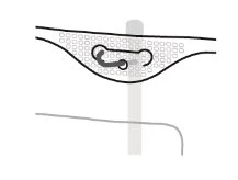 Schematic diagram showing a medical device inserted under the skin with a curved tube and a thin underlying line