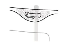 Diagramma schematico in bianco e nero che mostra un dispositivo medico inserito sotto la pelle con una linea verticale grigia di riferimento