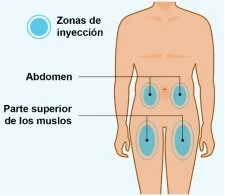 Diagramma del corpo umano che indica le zone di iniezione sottocutanea
