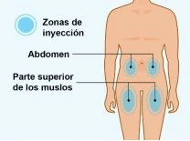 Diagramma di un corpo umano che indica le zone di iniezione sottocutanea