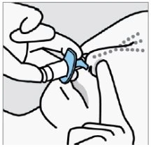 Mani che impugnano un dispositivo medico azzurro e bianco per applicarlo sulla pelle del corpo vicino a una serie di piccoli punti grigi