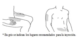 Disegno schematico di un busto maschile che mostra due aree grigie sulla parte superiore del braccio e sull