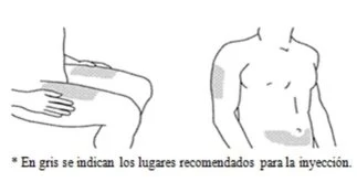 Disegni schematici di un torso maschile che indicano le zone grigie per l'iniezione