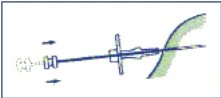 Diagramma tecnico che mostra l'inserimento di un ago sottile in un tessuto corporeo con frecce che indicano la direzione del movimento