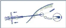 Diagramma medico che mostra l'inserimento di un ago sottocutaneo attraverso la pelle con un dettaglio ingrandito della punta dell'ago