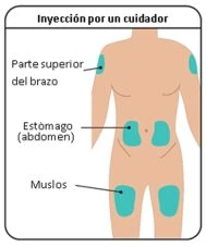Diagram ciała ludzkiego wskazujący obszary do wstrzykiwania