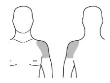 Diagramma schematico del torace maschile che mostra due viste, anteriore e posteriore, con la spalla sinistra evidenziata in grigio scuro