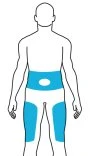 Schema del corpo umano stilizzato con aree azzurre evidenziate sulla zona addominale e sulla parte superiore delle cosce di entrambe le gambe