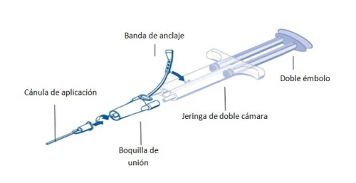 Technical diagram of a dual-chamber syringe with anchoring band, dual plunger, connecting nozzle, and application cannula