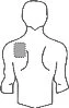 Stylized drawing of a man's torso with a rectangular gray area indicating the drug application site on the right shoulder