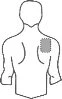 Stylized drawing of a man's torso with a gray circle indicating the area on the left shoulder for application